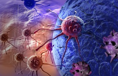 Darstellung von Krebszellen bei Krebserkrankungen