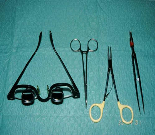 Lupenbrille und feinste Instrumente in der Schilddrüsenchirurgie